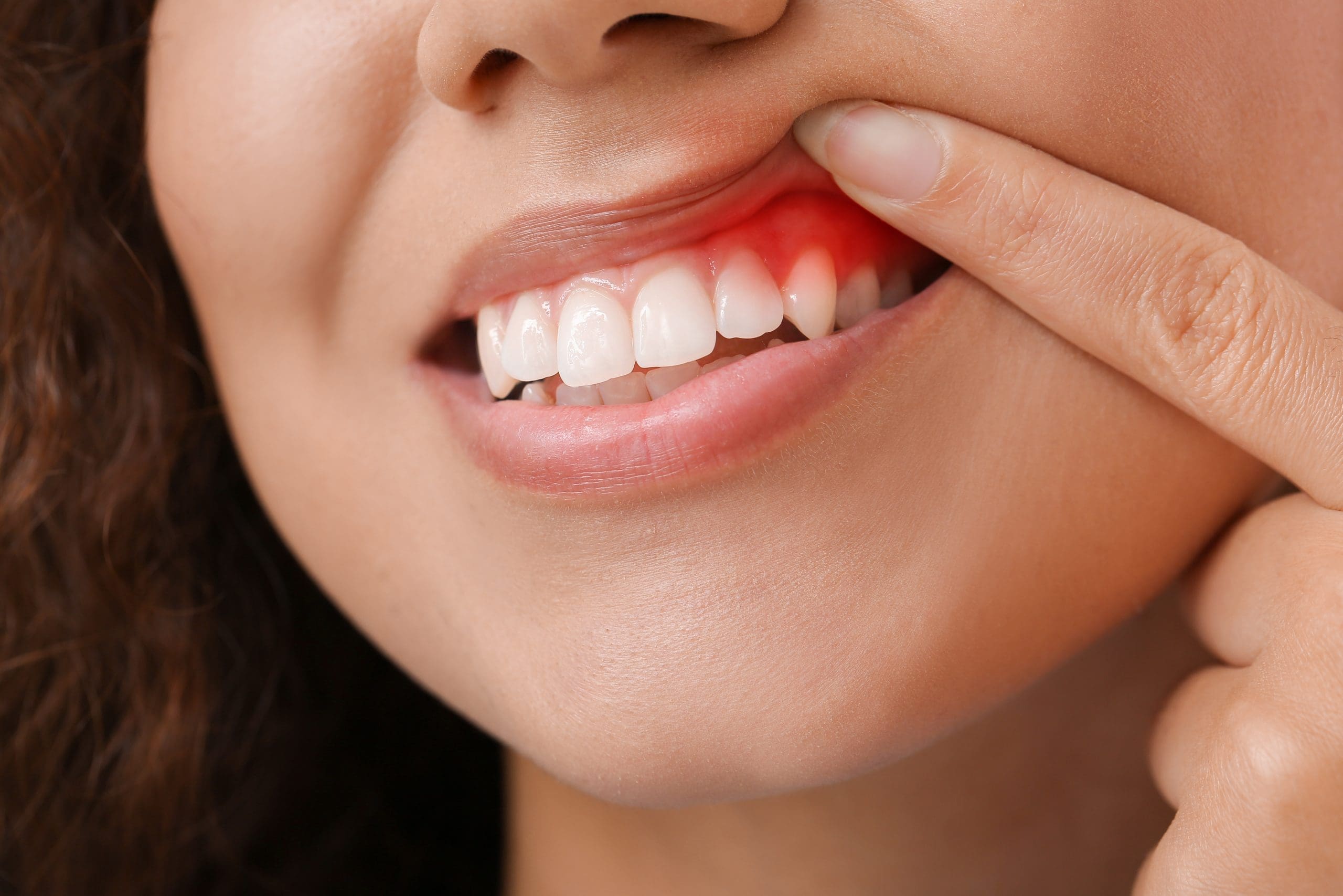 Arlington Heights Periodontal Gum Disease